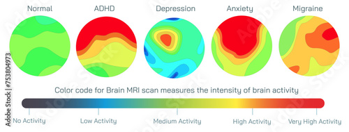 Brain MRI scan vector illustration. Magnetic resonance imaging is a medical imaging technique used in radiology to form pictures of the anatomy and the physiological processes inside the mind. 
