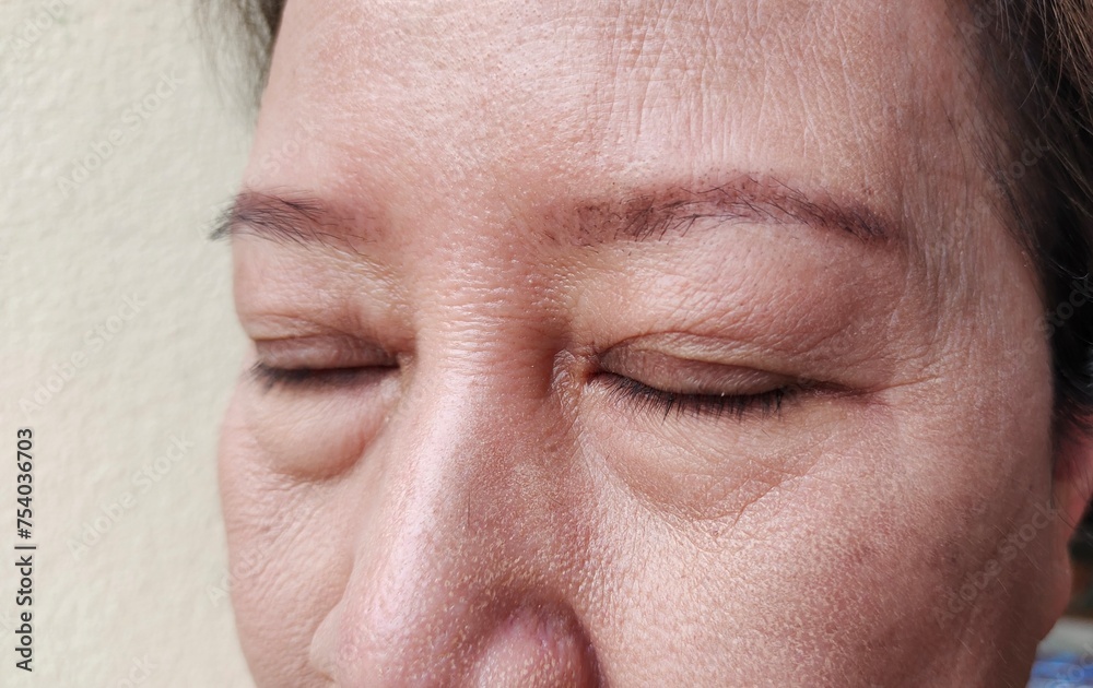 portrait showing the wrinkle and Flabby skin, swelling and loose under the eye, dark spots and blemish, Flabbiness and freckle on the face of the woman, health care and beauty concept. portrait showing the wrinkle and Flabby skin, swelling and loose under the eye, dark spots and blemish, Flabbiness and freckle on the face of the woman, health care and beauty concept.