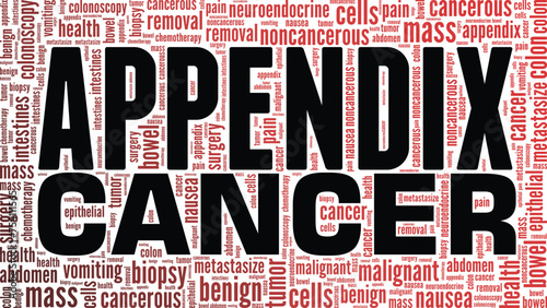 Appendix Cancer word cloud conceptual design isolated on white background.