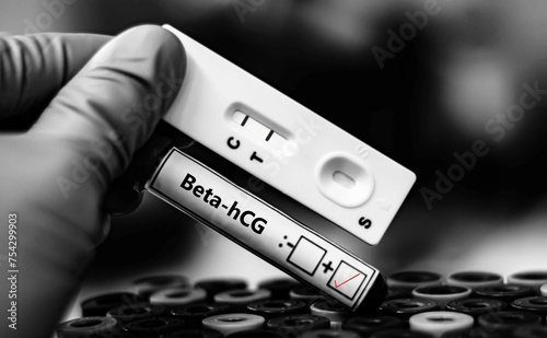 Blood sample of patient positive tested for beta-hCG by rapid diagnostic test. photo