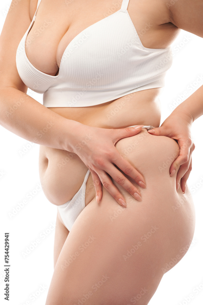 The girl stretches the skin on the leg and on the stomach, showing fat deposits. Treatment and getting rid of excess weight, the deposition of subcutaneous fat.