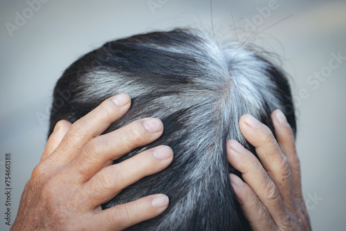 Back view of young people premature gray hair, showing black hoary hair roots on head change to senior old man outdoor. photo