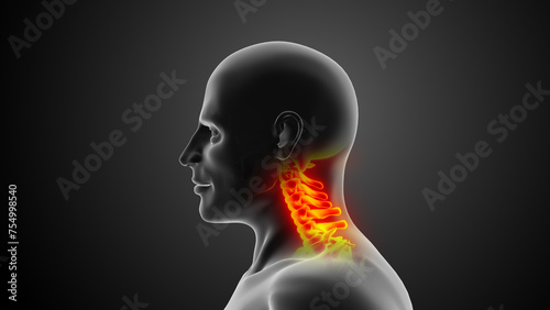Cervical spine or neck injuries