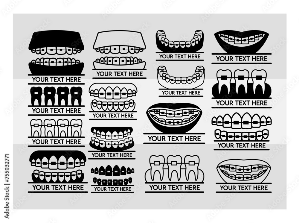 Fake Braces Split Monogram, Fake Braces Kit, Fake Braces Clip On