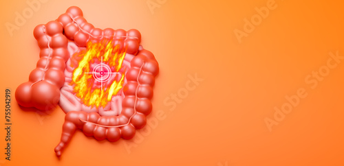 Human guts are on fire. Digestive problems. Heartburn in person intestines. Disease of gastrointestinal tract. Symptoms of heartburn in patient. Intestinal tract is at gunpoint on orange. 3d image photo