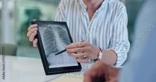 Wallpaper Mural Doctor, tablet and xray discussion in office with lung anatomy, surgery planning and analysis of medical results. Radiologist, patient and hands for healthcare review with chest and diagnosis report Torontodigital.ca
