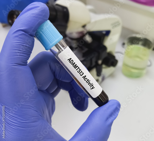 Blood sample for ADAMTS13 Activity or von Willebrand Factor Cleaving Protease test to diagnosis of thrombotic thrombocytopenic purpura (TTP). photo