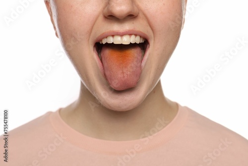 Gastrointestinal diseases. Woman showing her yellow tongue on white background, closeup photo