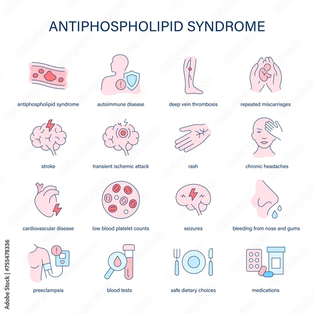 Antiphospholipid Syndrome Symptoms Diagnostic And Treatment Vector Antiphospholipid syndrome symptoms diagnostic and treatment vector