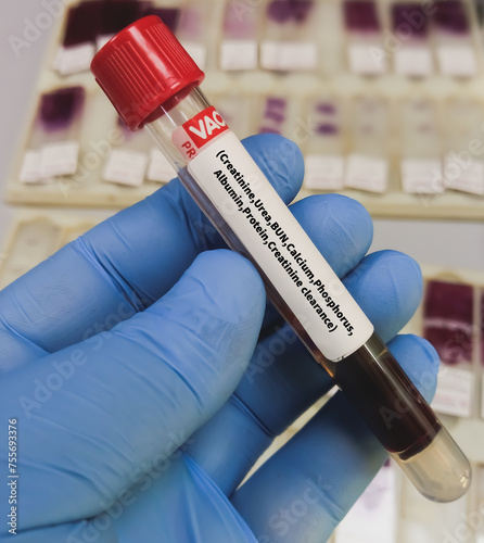 Blood sample for Renal Function test (Creatinine, BUN, eGFR, albumin, total protein, creatinine clearance) for diagnosis of renal or kidney disease. photo