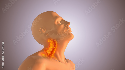 Neck or cervical spine injuries photo