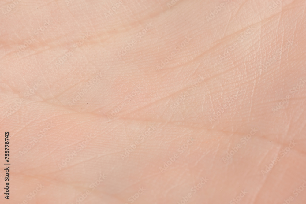 Fototapeta premium Texture of dry skin as background, macro view