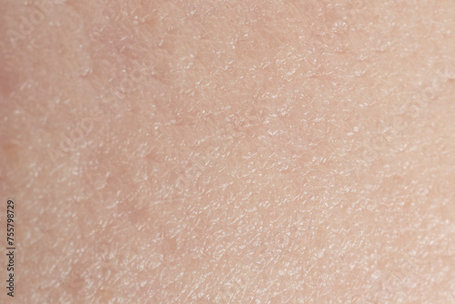 Texture of dry skin as background, macro view photo