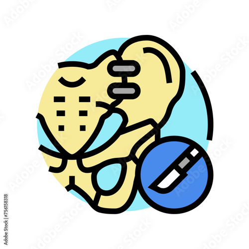 joint fusion surgery color icon vector. joint fusion surgery sign. isolated symbol illustration