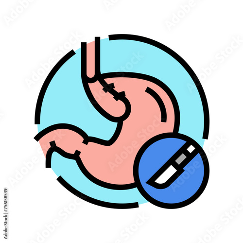 nissen fundoplication surgery color icon vector. nissen fundoplication surgery sign. isolated symbol illustration