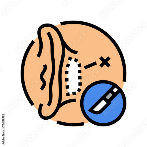 otoplasty surgery color icon vector. otoplasty surgery sign. isolated symbol illustration