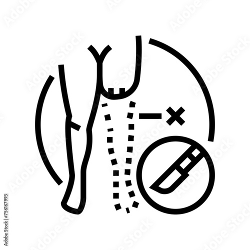 limb amputation surgery line icon vector. limb amputation surgery sign. isolated contour symbol black illustration