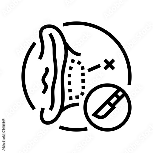 otoplasty surgery line icon vector. otoplasty surgery sign. isolated contour symbol black illustration