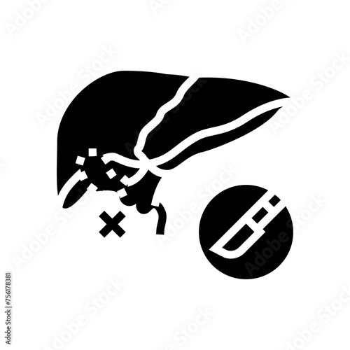 cholecystectomy surgery glyph icon vector. cholecystectomy surgery sign. isolated symbol illustration