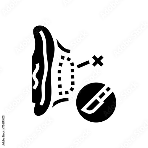 otoplasty surgery glyph icon vector. otoplasty surgery sign. isolated symbol illustration