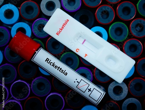 Blood sample of patient negative tested for rickettsia by rapid diagnostic test. photo