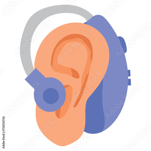 cochlear implant in ear photo