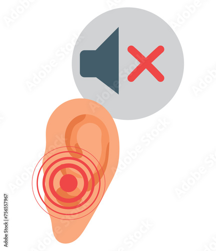 cochlear implant error sound