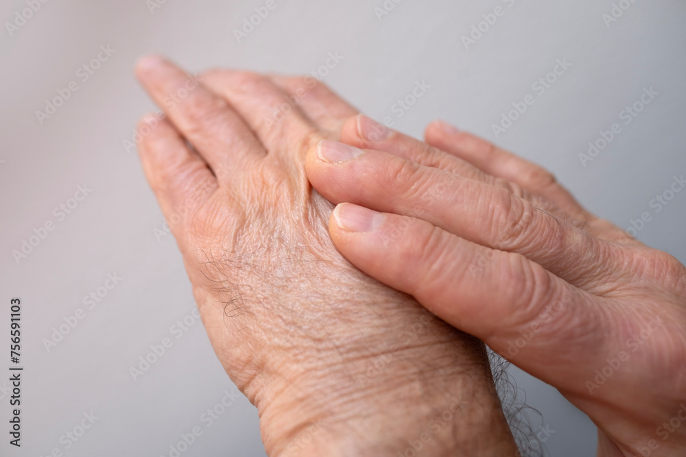 Fototapeta premium Man examining inflamed area on hand, self-massaging for pain relief, Skin health and care, disease prevention and maintenance health, performing self-massage, treatment of rheumatism, skin conditions
