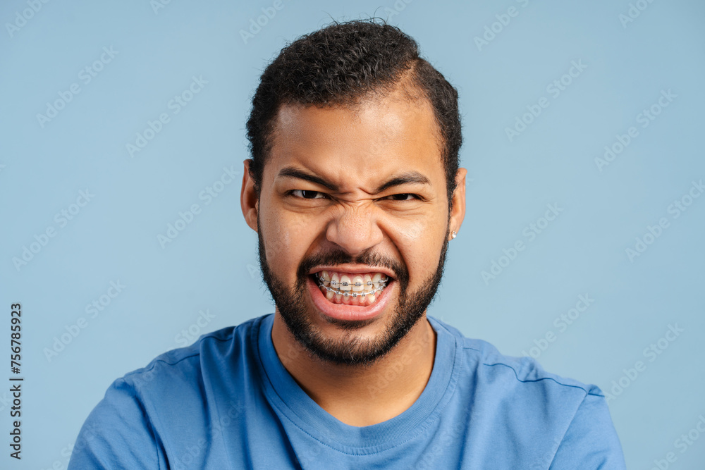 Expressive African American man with braces, grimacing with rage and looking at the camera - obrazy, fototapety, plakaty 