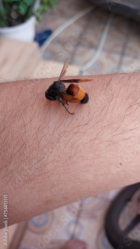 image of the bee stings hand