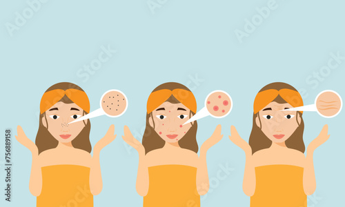 Young girl has skin problems with acne or allergic pimples on her face. Skincare and dermatology concept. Flat style vector illustration.