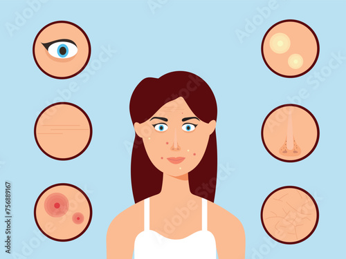 Young girl has skin problems with acne or allergic pimples on her face. Skincare and dermatology concept. Flat style vector illustration.