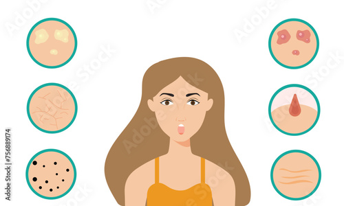 Young girl has skin problems with acne or allergic pimples on her face. Skincare and dermatology concept. Flat style vector illustration.