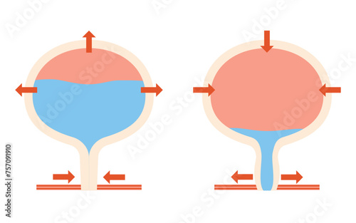 正常な膀胱の医療イラスト、排尿の仕組み