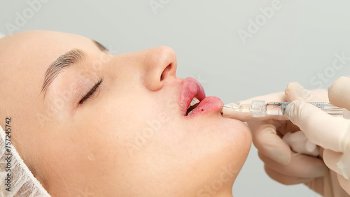 Injection procedure for lip augmentation, close-up. The cosmetologist slowly and carefully injects filler into the client’s lips. Advertising concept for facial care, youth and beauty.