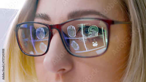 Close-up of glasses and reflection of MRI scan panorama. Close-up of a woman wearing glasses looking at a laptop, with multiple MRI scans of her head visible in the reflection of the glasses. photo