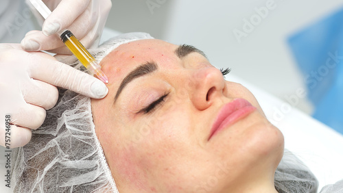 Medical cosmetology of plasma injections. Cosmetology, facial injections close-up. A professional cosmetologist, doctor does mesotherapy, plasma therapy to a young woman.