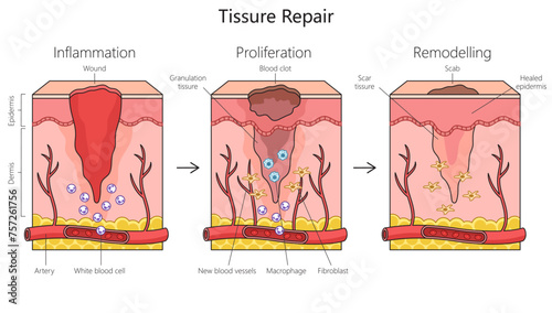 Tissue repair structure diagram hand drawn schematic vector illustration. Medical science educational illustration