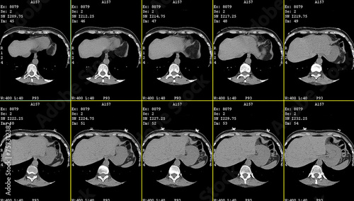 Foto Axial contrast of the cardio system with radiology