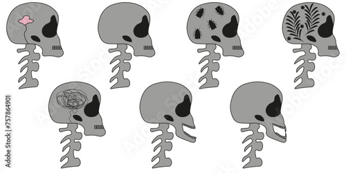 X-Ray Skull set isolated white background. Funky roentgen human scull with creative brain. Vector illustration can used medical poster design. EPS 10 Editable stroke.
