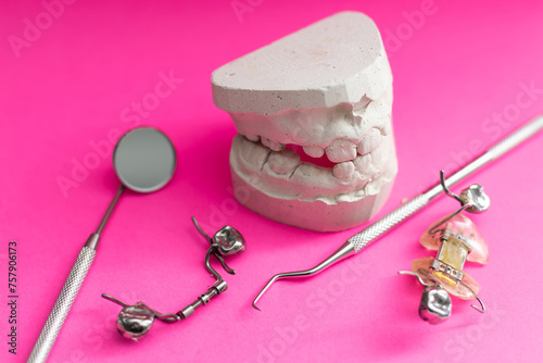 Dental casting gypsum model plaster cast stomatologic human jaws prothetic laboratory. dental plate photo