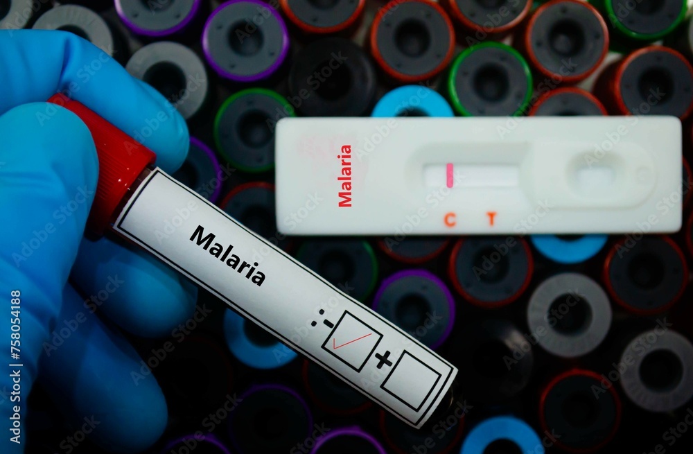Obraz premium Blood sample of patient negative tested for malaria by rapid diagnostic test.