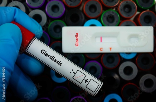 Blood sample of patient negative tested for giardiasis by rapid diagnostic test. photo
