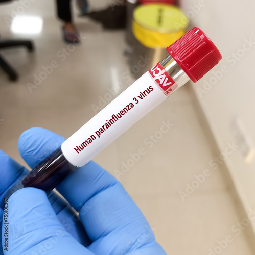 Blood sample for Human parainfluenza 3 virus (HPIV3) test. photo