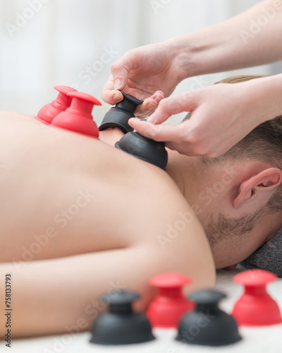 physiotherapist performs vacuum back massage on patient. Silicone jars. woman doctor gives vacuum cupping massage to man. Lymphatic drainage, blood flow. Side View . Close-up. High quality photo