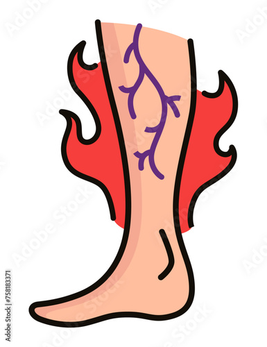 Varicose treatment icon. Violation of circulatory system. Vascular disease diagnostic. Venous insufficiency medical disease. Vector illustration