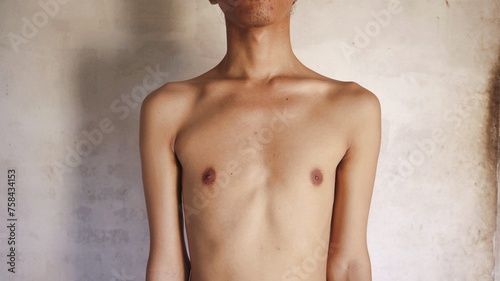 Tableau sur toile thin male body shape