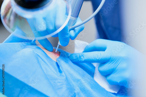 Obraz na płótnie Laseroterapia w medycynie. Odmładzanie, regeneracja skóry, usuwanie blizn. w salonie