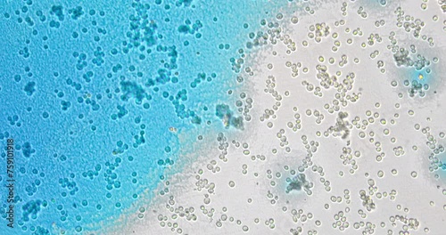 Hydrogen production (H2) Hydrogen bacteria under the microscope, enzymatic production of hydrogen from organic matter. Hydrogen as a renewable energy source photo