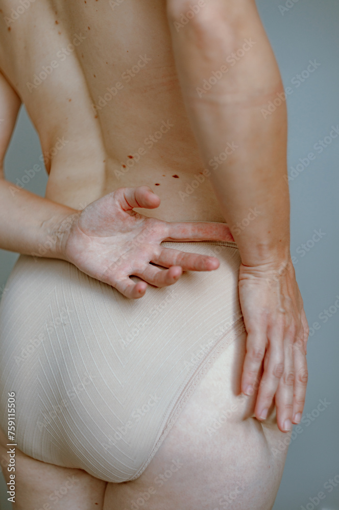 custom made wallpaper toronto digital
Detail of a woman's naked back with a hand on her thigh with a scar